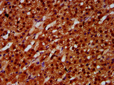 ETV5 / ERM Antibody - Immunohistochemistry Dilution at 1:600 and staining in paraffin-embedded human adrenal gland tissue performed on a Leica BondTM system. After dewaxing and hydration, antigen retrieval was mediated by high pressure in a citrate buffer (pH 6.0). Section was blocked with 10% normal Goat serum 30min at RT. Then primary antibody (1% BSA) was incubated at 4°C overnight. The primary is detected by a biotinylated Secondary antibody and visualized using an HRP conjugated SP system.
