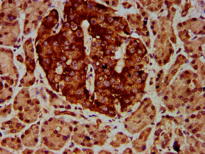 ETV5 / ERM Antibody - Immunohistochemistry Dilution at 1:600 and staining in paraffin-embedded human pancreatic tissue performed on a Leica BondTM system. After dewaxing and hydration, antigen retrieval was mediated by high pressure in a citrate buffer (pH 6.0). Section was blocked with 10% normal Goat serum 30min at RT. Then primary antibody (1% BSA) was incubated at 4°C overnight. The primary is detected by a biotinylated Secondary antibody and visualized using an HRP conjugated SP system.