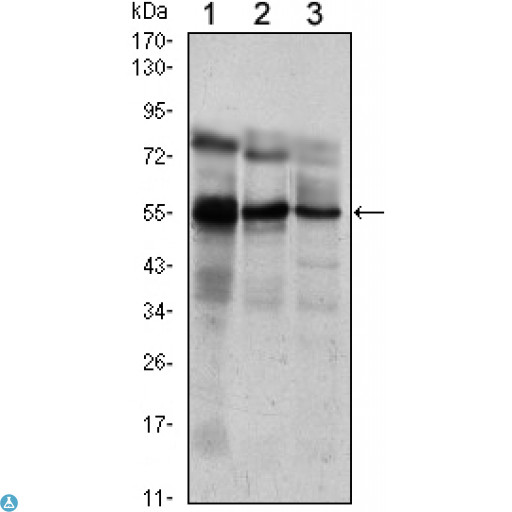 ETV5 / ERM Antibody - Western Blot (WB) analysis using ERM Monoclonal Antibody against Jurkat (1), NIH/3T3 (2) and MCF-7 (3) cell lysate.