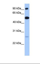 ETV5 / ERM Antibody - Fetal lung lysate. Antibody concentration: 1.0 ug/ml. Gel concentration: 12%.  This image was taken for the unconjugated form of this product. Other forms have not been tested.