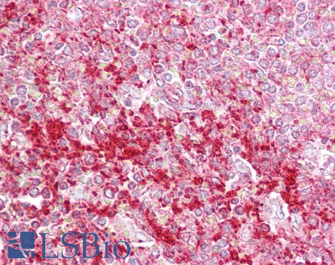 ETV5 / ERM Antibody - Anti-ETV5 antibody IHC of human spleen. Immunohistochemistry of formalin-fixed, paraffin-embedded tissue after heat-induced antigen retrieval. Antibody concentration 5 ug/ml.  This image was taken for the unconjugated form of this product. Other forms have not been tested.