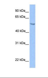 ETV5 / ERM Antibody - Transfected 293T cell lysate. Antibody concentration: 1.0 ug/ml. Gel concentration: 12%.  This image was taken for the unconjugated form of this product. Other forms have not been tested.