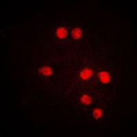 ETV6 / TEL Antibody - Immunofluorescent analysis of TEL staining in Jurkat cells. Formalin-fixed cells were permeabilized with 0.1% Triton X-100 in TBS for 5-10 minutes and blocked with 3% BSA-PBS for 30 minutes at room temperature. Cells were probed with the primary antibody in 3% BSA-PBS and incubated overnight at 4 C in a humidified chamber. Cells were washed with PBST and incubated with a DyLight 594-conjugated secondary antibody (red) in PBS at room temperature in the dark. DAPI was used to stain the cell nuclei (blue).