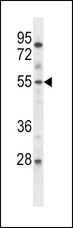 ETV6 / TEL Antibody - ETV6 Antibody western blot of mouse lung tissue lysates (35 ug/lane). The ETV6 antibody detected the ETV6 protein (arrow).