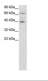 ETV6 / TEL Antibody - Jurkat Cell Lysate.  This image was taken for the unconjugated form of this product. Other forms have not been tested.