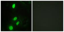 ETV6 / TEL Antibody - Immunofluorescence analysis of HeLa cells, using ETV6 Antibody. The picture on the right is blocked with the synthesized peptide.