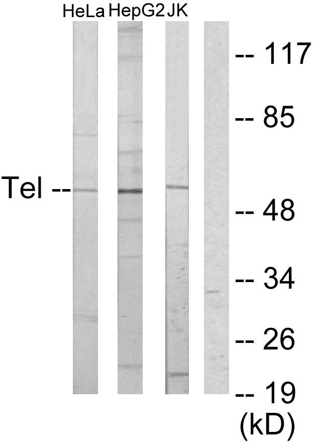 ETV6 / TEL Antibody - Western blot analysis of lysates from HeLa, HepG2, and Jurkat cells, using ETV6 Antibody. The lane on the right is blocked with the synthesized peptide.