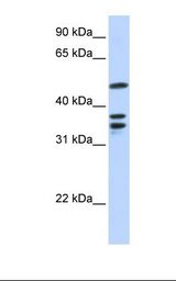 ETV6 / TEL Antibody - 721_B cell lysate. Antibody concentration: 1.0 ug/ml. Gel concentration: 12%.  This image was taken for the unconjugated form of this product. Other forms have not been tested.