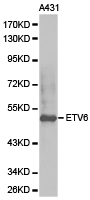 ETV6 / TEL Antibody - Western blot of extracts of A431 cell lines, using ETV6 antibody.