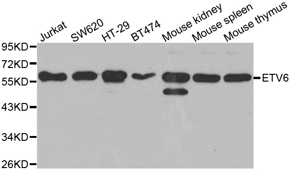 ETV6 / TEL Antibody - Western blot analysis of extracts of various cell lines.