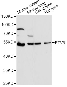ETV6 / TEL Antibody - Western blot analysis of extracts of various cell lines, using ETV6 antibody at 1:1000 dilution. The secondary antibody used was an HRP Goat Anti-Rabbit IgG (H+L) at 1:10000 dilution. Lysates were loaded 25ug per lane and 3% nonfat dry milk in TBST was used for blocking. An ECL Kit was used for detection and the exposure time was 90s.
