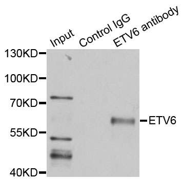 ETV6 / TEL Antibody - Immunoprecipitation analysis of 200ug extracts of SW620 cells using 3ug ETV6 antibody. Western blot was performed from the immunoprecipitate using ETV6 antibodyat a dilition of 1:500.