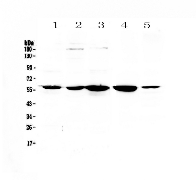 ETV6 / TEL Antibody - Western blot - Anti-ETV6/Tel Picoband antibody