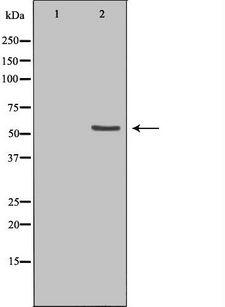 ETV6 / TEL Antibody - Western blot analysis of extracts of HeLa cells using ETV6 antibody. The lane on the left is treated with the antigen-specific peptide.