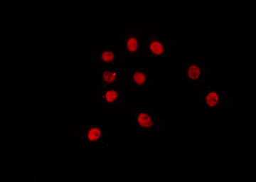 ETV6 / TEL Antibody - Staining HepG2 cells by IF/ICC. The samples were fixed with PFA and permeabilized in 0.1% Triton X-100, then blocked in 10% serum for 45 min at 25°C. The primary antibody was diluted at 1:200 and incubated with the sample for 1 hour at 37°C. An Alexa Fluor 594 conjugated goat anti-rabbit IgG (H+L) Ab, diluted at 1/600, was used as the secondary antibody.