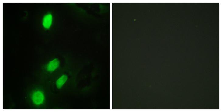 ETV6 / TEL Antibody - Peptide - + Immunofluorescence analysis of HeLa cells, using ETV6 antibody.