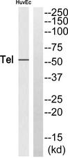 ETV6 / TEL Antibody - Western blot analysis of extracts from HuvEc cells, using Tel (Ab-257) antibody.