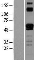ETV6 / TEL Protein - Western validation with an anti-DDK antibody * L: Control HEK293 lysate R: Over-expression lysate