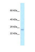 EVA1B Antibody - Fam176b antibody Western blot of Rat Lung lysate. Antibody concentration 1 ug/ml.  This image was taken for the unconjugated form of this product. Other forms have not been tested.