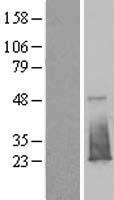 EVA1B Protein - Western validation with an anti-DDK antibody * L: Control HEK293 lysate R: Over-expression lysate