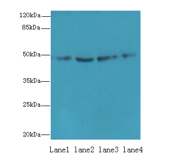 EVA1C Antibody - Western blot. All lanes: EVA1C antibody at 5 ug/ml. Lane 1: HeLa whole cell lysate. Lane 2: Jurkat whole cell lysate. Lane 3: 293T whole cell lysate. Lane 4: HL60 whole cell lysate. Secondary Goat polyclonal to Rabbit IgG at 1:10000 dilution. Predicted band size: 49 kDa. Observed band size: 49 kDa.