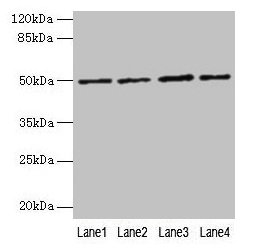 EVA1C Antibody - Western blot All lanes: EVA1C antibody at 5µg/ml Lane 1: Hela whole cell lysate Lane 2: Jurkat whole cell lysate Lane 3: 293T whole cell lysate Lane 4: HL60 whole cell lysate Secondary Goat polyclonal to rabbit IgG at 1/10000 dilution Predicted band size: 50, 8 kDa Observed band size: 50 kDa