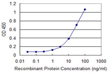 EVC / DWF-1 Antibody - Detection limit for recombinant GST tagged EVC is 0.3 ng/ml as a capture antibody.