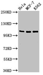 EVC / DWF-1 Antibody - Positive Western Blot detected in Hela whole cell lysate, MCF-7 whole cell lysate, K562 whole cell lysate. All lanes: EVC antibody at 2 µg/ml Secondary Goat polyclonal to rabbit IgG at 1/50000 dilution. Predicted band size: 112 KDa. Observed band size: 112 KDa