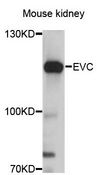 EVC / DWF-1 Antibody - Western blot analysis of extracts of mouse kidney, using EVC antibody at 1:3000 dilution. The secondary antibody used was an HRP Goat Anti-Rabbit IgG (H+L) at 1:10000 dilution. Lysates were loaded 25ug per lane and 3% nonfat dry milk in TBST was used for blocking. An ECL Kit was used for detection and the exposure time was 10s.