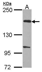 EVC2 Antibody - Sample (30 ug of whole cell lysate). A: H1299. 5% SDS PAGE. EVC2 antibody. EVC2 antibody diluted at 1:1000.