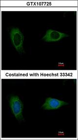 EVC2 Antibody - Immunofluorescence of methanol-fixed HeLa using EVC2 antibody at 1:500 dilution.