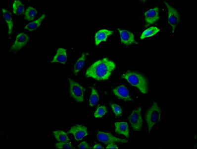 EVC2 Antibody - Immunofluorescence staining of A549 cells diluted at 1:66, counter-stained with DAPI. The cells were fixed in 4% formaldehyde, permeabilized using 0.2% Triton X-100 and blocked in 10% normal Goat Serum. The cells were then incubated with the antibody overnight at 4°C.The Secondary antibody was Alexa Fluor 488-congugated AffiniPure Goat Anti-Rabbit IgG (H+L).