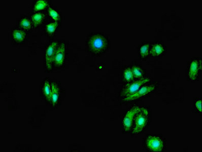 EVI2A Antibody - Immunofluorescent analysis of HepG2 cells using EVI2A Antibody at dilution of 1:100 and Alexa Fluor 488-congugated AffiniPure Goat Anti-Rabbit IgG(H+L)