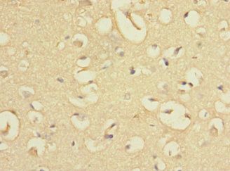 EVI2A Antibody - Immunohistochemistry of paraffin-embedded human brain tissue using EVI2A Antibody at dilution of 1:100