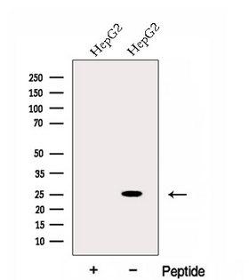 EVI2A Antibody - Western blot analysis of extracts of HepG2 cells using EVI2A antibody. The lane on the left was treated with blocking peptide.