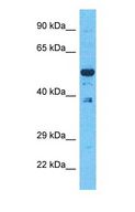 EVI2B Antibody - Western blot of EVI2B Antibody with human 293T Whole Cell lysate.  This image was taken for the unconjugated form of this product. Other forms have not been tested.