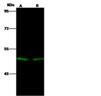 EVI2B Antibody - Anti-EVI2B rabbit polyclonal antibody at 1:500 dilution. Lane A: Mouse heart tissue lysate Whole Cell Lysate. Lane B: Mouse spleen tissue lysate Whole Cell Lysate. Lysates/proteins at 30 ug per lane. Secondary: Goat Anti-Rabbit IgG H&L (Dylight 800) at 1/10000 dilution. Developed using the Odyssey technique. Performed under reducing conditions. Predicted band size: 49 kDa. Observed band size: 49 kDa.