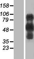 EVI2B Protein - Western validation with an anti-DDK antibody * L: Control HEK293 lysate R: Over-expression lysate