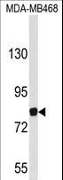 EVI5 Antibody - Western blot of EVI5 Antibody in MDA-MB468 cell line lysates (35 ug/lane). EVI5 (arrow) was detected using the purified antibody.
