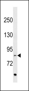 EVI5L Antibody - EVI5L Antibody western blot of MDA-MB453 cell line lysates (35 ug/lane). The EVI5L antibody detected the EVI5L protein (arrow).
