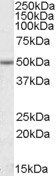 EVL Antibody - EVL antibody (1 ug/ml) staining of Jurkat lysate (35 ug protein/ml in RIPA buffer). Primary incubation was 1 hour. Detected by chemiluminescence.