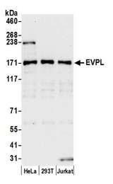 EVPL / Envoplakin Antibody - Detection of human EVPL by western blot. Samples: Whole cell lysate (15 µg) from HeLa, HEK293T, and Jurkat cells prepared using NETN lysis buffer. Antibody: Affinity purified rabbit anti-EVPL antibody used for WB at 1:1000. Detection: Chemiluminescence with an exposure time of 30 seconds.