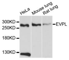 EVPL / Envoplakin Antibody - Western blot analysis of extracts of various cell lines, using EVPL antibody at 1:1000 dilution. The secondary antibody used was an HRP Goat Anti-Rabbit IgG (H+L) at 1:10000 dilution. Lysates were loaded 25ug per lane and 3% nonfat dry milk in TBST was used for blocking. An ECL Kit was used for detection and the exposure time was 90s.