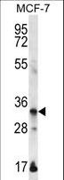 EVPLL Antibody - EVPLL Antibody western blot of MCF-7 cell line lysates (35 ug/lane). The EVPLL antibody detected the EVPLL protein (arrow).