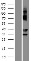 EVPLL Protein - Western validation with an anti-DDK antibody * L: Control HEK293 lysate R: Over-expression lysate