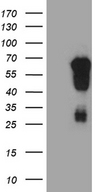 EVX1 Antibody - HEK293T cells were transfected with the pCMV6-ENTRY control. (Left lane) or pCMV6-ENTRY EVX1. (Right lane) cDNA for 48 hrs and lysed