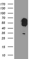 EVX1 Antibody - HEK293T cells were transfected with the pCMV6-ENTRY control. (Left lane) or pCMV6-ENTRY EVX1. (Right lane) cDNA for 48 hrs and lysed. Equivalent amounts of cell lysates. (5 ug per lane) were separated by SDS-PAGE and immunoblotted with anti-EVX1. (1:2000)