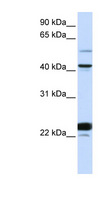 EVX1 Antibody - EVX1 antibody Western blot of HeLa lysate. This image was taken for the unconjugated form of this product. Other forms have not been tested.