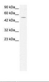 EVX1 Antibody - Jurkat Cell Lysate.  This image was taken for the unconjugated form of this product. Other forms have not been tested.