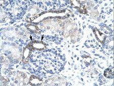 EVX1 Antibody - EVX1 antibody P100830_T100-NP_001980-EVX1 (even-skipped homeobox 1) Antibody was used in IHC to stain formalin-fixed, paraffin-embedded human kidney.  This image was taken for the unconjugated form of this product. Other forms have not been tested.